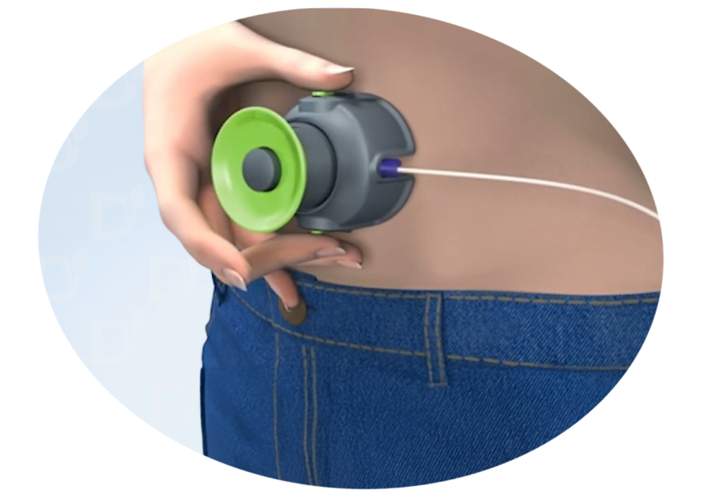 БЛОГ-0002.png БЛОГ-0002.png