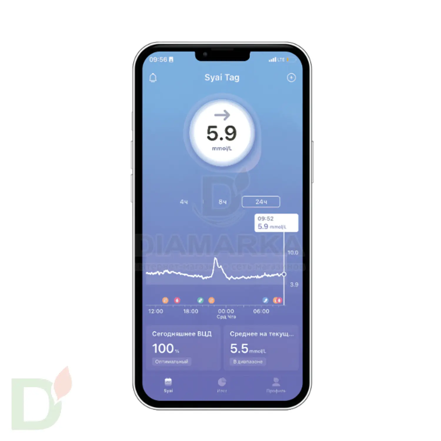 Сенсор (датчик) Syai X1 Сенсор (датчик) Syai X1